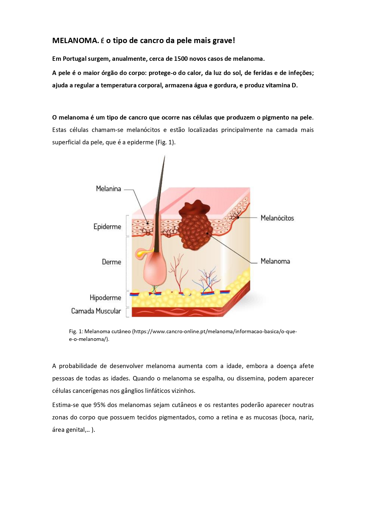 MELANOMA. É o tipo de cancro da pele mais grave page 0001